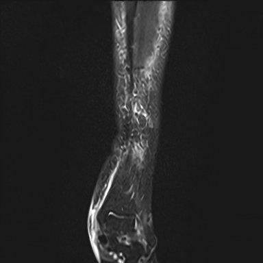 STIR janela padrão