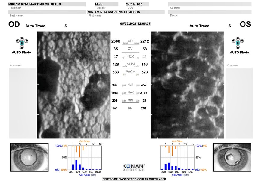 Microscopia realce regional