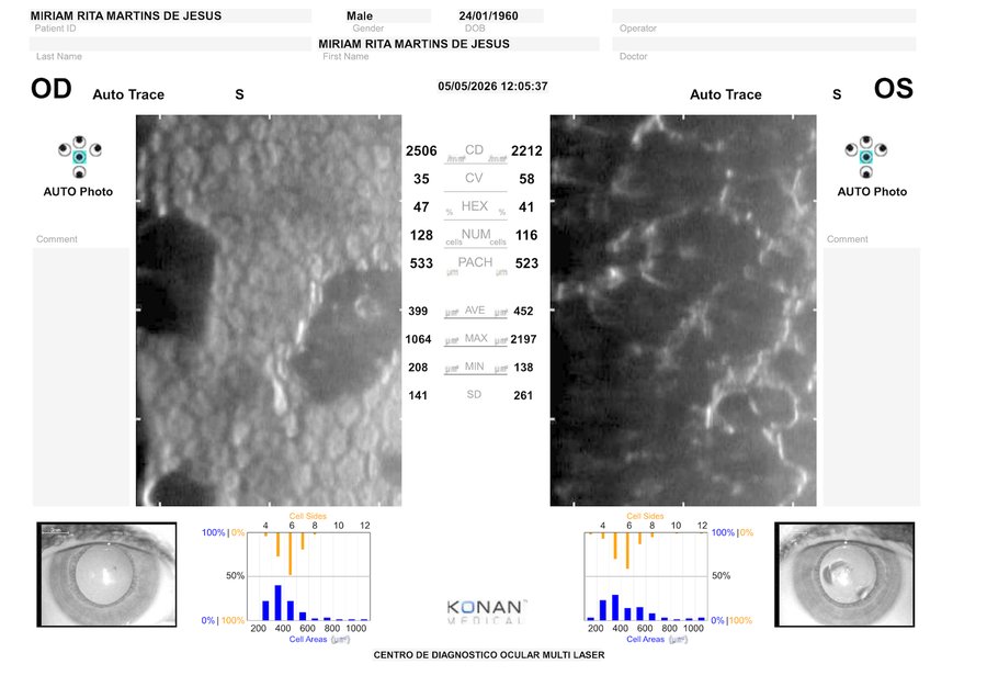 Microscopia áreas escuras