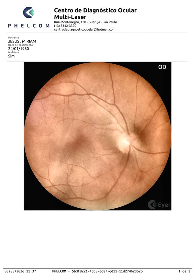 Retinografia realce regional