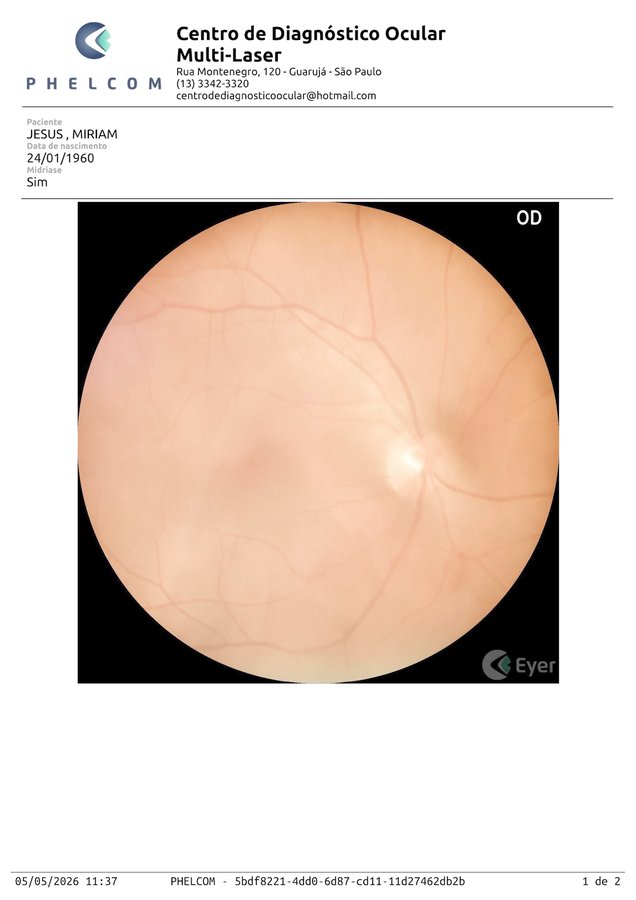Retinografia áreas escuras