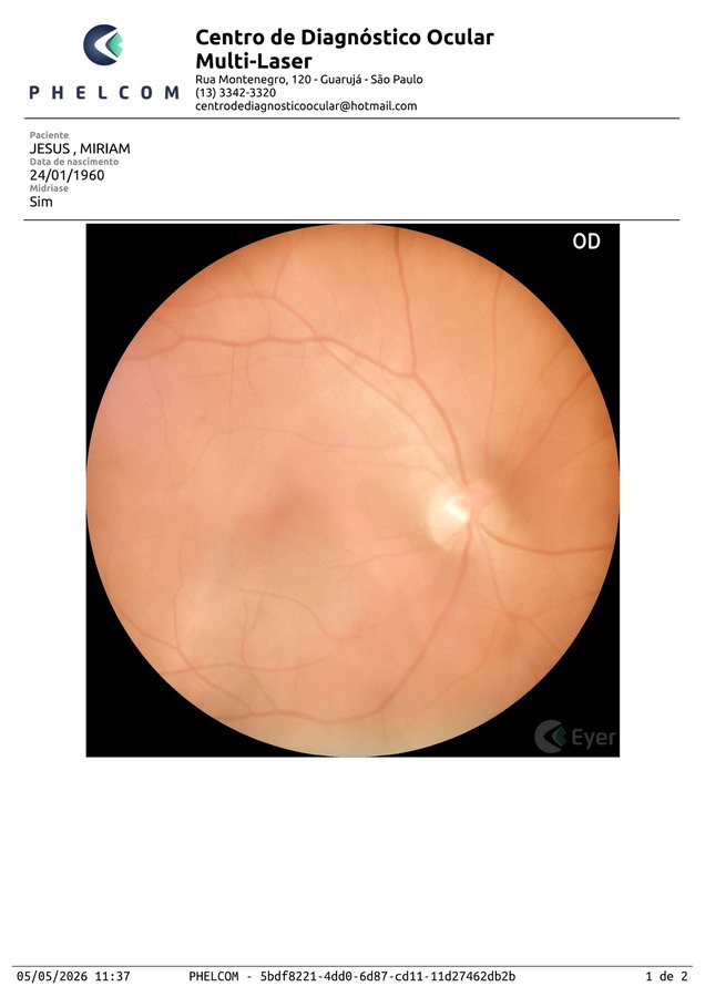 Retinografia padrão